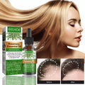 Lova Glow Hair Growth Scalp Treatment