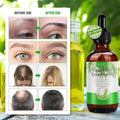 Lova Glow Hair Growth Scalp Treatment